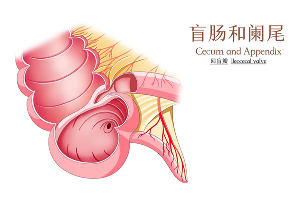 阑尾炎不能吃什么