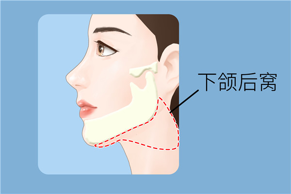 双下巴怎么瘦 双下巴如何瘦