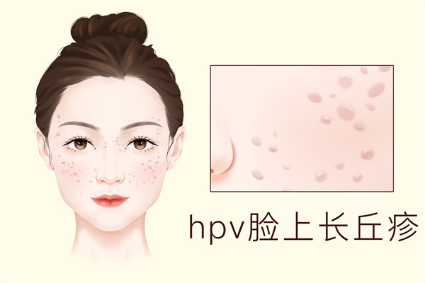 HPV是什么意思是什么病 HPV有什么含义