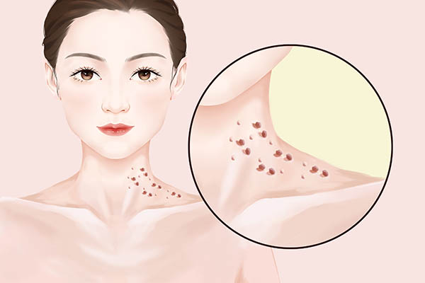 HPV24阳性是什么