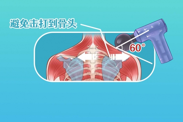 筋膜枪的作用和功能