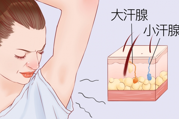 治疗腋臭哪家医院好 哪家医院治疗腋臭好