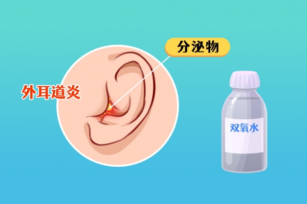 耳朵耳屎怎么清理