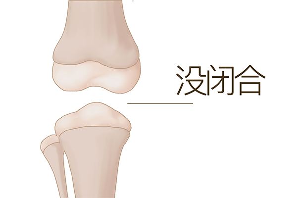 17岁骨骺线闭合了还能长高吗