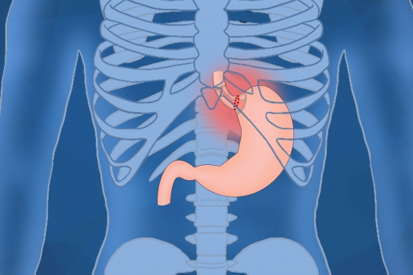 砂糖橘对消化系统的好处有哪些